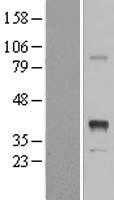 Inhibin beta E chain(INHBE) (NM_031479) Human Tagged ORF Clone