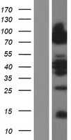 Lipolysis Stimulated Lipoprotein Receptor(LSR) (NM_205834) Human Tagged ORF Clone