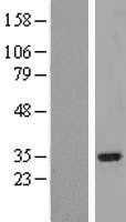 IRAK1BP1 (NM_001010844) Human Tagged ORF Clone