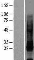 IL32 (NM_004221) Human Tagged ORF Clone