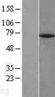 ZNF354A (NM_005649) Human Tagged ORF Clone