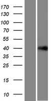 LRRC58 (NM_001099678) Human Tagged ORF Clone
