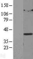 LPGAT1 (NM_014873) Human Tagged ORF Clone