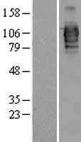 LRRC50(DNAAF1) (NM_178452) Human Tagged ORF Clone