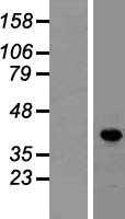 LDB1 (NM_003893) Human Tagged ORF Clone