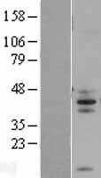 FAIM3(FCMR) (NM_005449) Human Tagged ORF Clone
