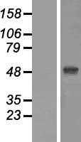 ZIC1 (NM_003412) Human Tagged ORF Clone
