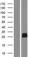 FAM101B(RFLNB) (NM_182705) Human Tagged ORF Clone