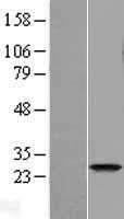 FAM119A(METTL21A) (NM_145280) Human Tagged ORF Clone