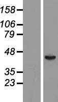 FT1A(FUT6) (NM_000150) Human Tagged ORF Clone