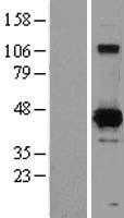XRCC4 (NM_022550) Human Tagged ORF Clone
