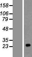 FAM177A1 (NM_173607) Human Tagged ORF Clone
