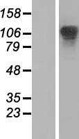 XRN2 (NM_012255) Human Tagged ORF Clone