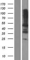 Leupaxin(LPXN) (NM_001143995) Human Tagged ORF Clone