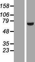 LIM kinase 2(LIMK2) (NM_016733) Human Tagged ORF Clone
