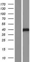 Z DNA binding protein(ZBP1) (NM_001160418) Human Tagged ORF Clone