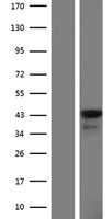 Leukotriene B4 Receptor 2(LTB4R2) (NM_001164692) Human Tagged ORF Clone
