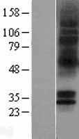 5HT5A receptor(HTR5A) (NM_024012) Human Tagged ORF Clone