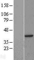 BRCC36(BRCC3) (NM_024332) Human Tagged ORF Clone