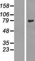 ZNF274 (NM_133502) Human Tagged ORF Clone