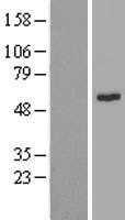 Integrin Linked Kinase(ILK) (NM_001014794) Human Tagged ORF Clone