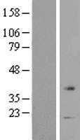 VN1R1 (NM_020633) Human Tagged ORF Clone