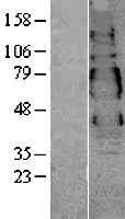 VSIG1 (NM_182607) Human Tagged ORF Clone