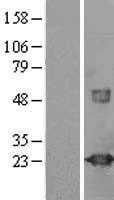 VILIP1(VSNL1) (NM_003385) Human Tagged ORF Clone