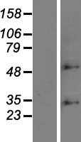 ZDHHC6 (NM_022494) Human Tagged ORF Clone