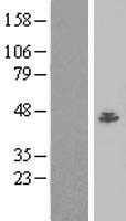BAF53A(ACTL6A) (NM_177989) Human Tagged ORF Clone