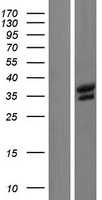 BRCC36(BRCC3) (NM_001018055) Human Tagged ORF Clone