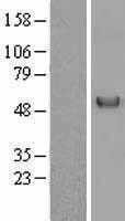 Vitamin D Binding protein(GC) (NM_000583) Human Tagged ORF Clone