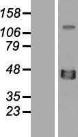 XRCC4 (NM_003401) Human Tagged ORF Clone