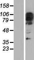 ZNF512B (NM_020713) Human Tagged ORF Clone