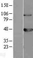 BCKDH kinase(BCKDK) (NM_005881) Human Tagged ORF Clone
