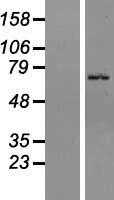 ZNF133 (NM_003434) Human Tagged ORF Clone