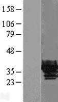 beta B1 Crystallin(CRYBB1) (NM_001887) Human Tagged ORF Clone
