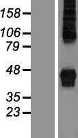ZDHHC14 (NM_153746) Human Tagged ORF Clone