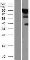 ZC3H14 (NM_001160104) Human Tagged ORF Clone