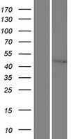 XPD(ERCC2) (NM_001130867) Human Tagged ORF Clone