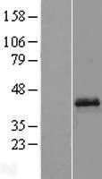 Opticin(OPTC) (NM_014359) Human Tagged ORF Clone
