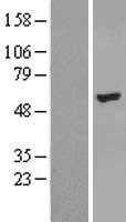 ZNF385B (NM_152520) Human Tagged ORF Clone