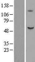 B3GALNT2 (NM_152490) Human Tagged ORF Clone