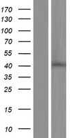 ZDHHC16 (NM_198043) Human Tagged ORF Clone