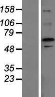 ZFP64 (NM_199427) Human Tagged ORF Clone