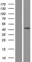 OTX3(DMBX1) (NM_172225) Human Tagged ORF Clone