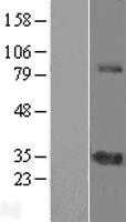 ZNF691 (NM_015911) Human Tagged ORF Clone