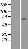ZNF549 (NM_153263) Human Tagged ORF Clone