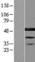 BZW2 (NM_001159767) Human Tagged ORF Clone