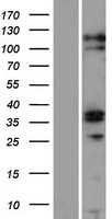 ZC3H12C (NM_033390) Human Tagged ORF Clone